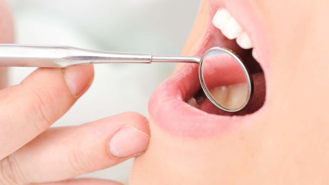 Common Dental Disorders