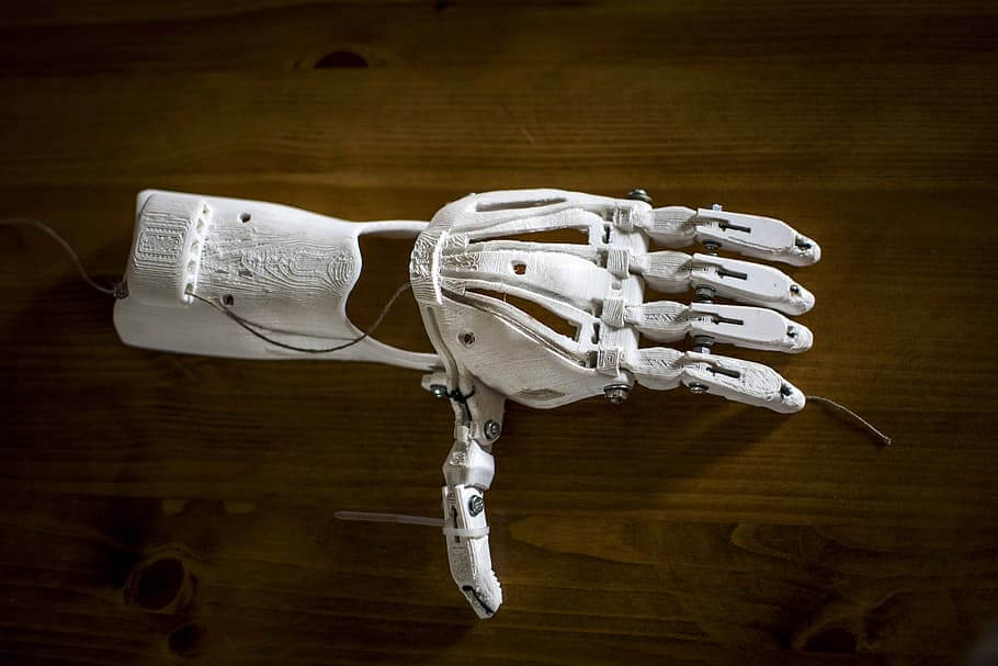 3D-printed Prosthetic